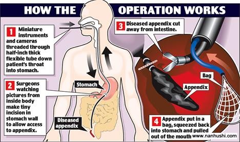 /medical/UploadFiles_5263/200804/2008041917213314.jpg