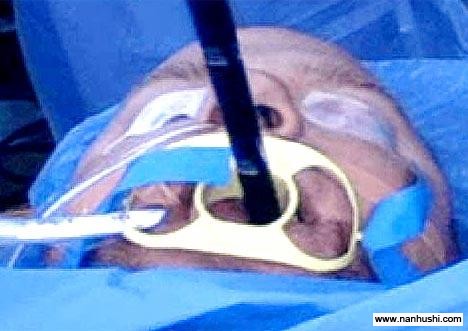 /medical/UploadFiles_5263/200804/2008041917213323.jpg